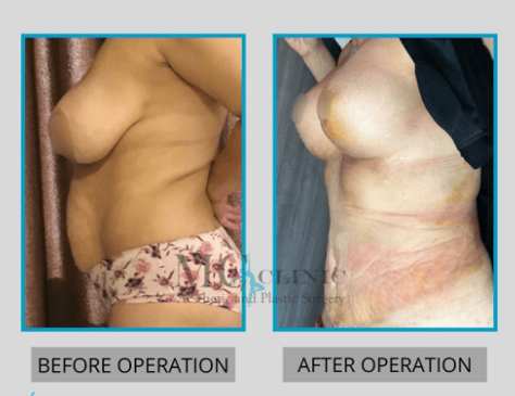 Slider image (3) MEHMET CEBER CLINIC